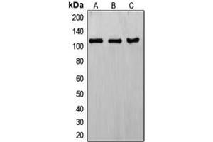 Western blot analysis of ERCC4 expression in HeLa (A), KNRK (B), MCF7 (C) whole cell lysates. (ERCC4 Antikörper  (C-Term))