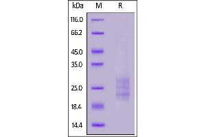 SDS-PAGE (SDS) image for Interleukin 33 (IL33) (AA 109-266) protein (His tag) (ABIN7013526)