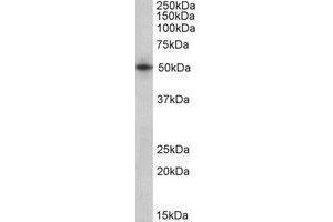 AP22419PU-N ARTS antibody staining of Human Heart lysate at 1µg/ml (35µg protein in RIPA buffer).