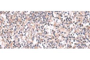 Immunohistochemistry of paraffin-embedded Human tonsil tissue using GSPT2 Polyclonal Antibody at dilution of 1:50(x200)