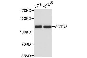 Western blot analysis of extracts of various cell lines, using ACTN3 antibody. (ACTN3 Antikörper  (AA 580-630))