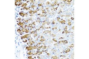 Immunohistochemistry of paraffin-embedded mouse stomach using MGP antibody at dilution of 1:100 (40x lens). (MGP Antikörper)