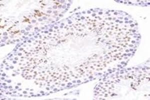 Immunohistochemistry analysis of paraffin-embedded mouse testis using,ACRBP (ABIN7072890) at dilution of 1: 8000