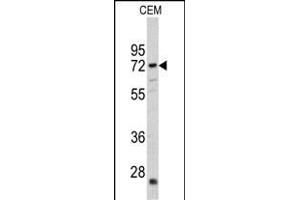 Western blot analysis of CRAT antibody (N-term) (ABIN390481 and ABIN2840845) in CEM cell line lysates (35 μg/lane). (CRAT Antikörper  (N-Term))