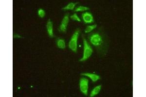 IHC-P analysis of HeLa cells, with FITC staining. (MAP4 Antikörper  (AA 2-250))