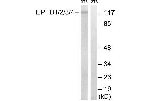 Western blot analysis of extracts from 3T3 cells, treated with heat shock, using EPHB1/2/3/4 (Ab-600/602/614/596) antibody. (EPH Receptor B1/2/3/4 (Tyr600) Antikörper)