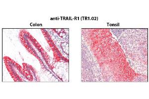 Immunohistochemistry detection of endogenous TRAIL-R1 in paraffin-embedded human carcinoma tissues (colon, tonsil) using mAb to TRAIL-R1 (TR1.