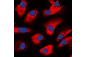 Immunofluorescent analysis of PKC zeta staining in HeLa cells. (PKC zeta Antikörper  (C-Term))