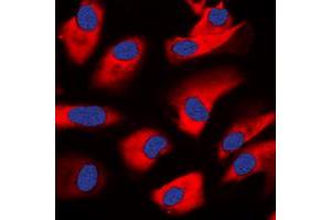 Immunofluorescent analysis of PKC zeta staining in HeLa cells. (PKC zeta Antikörper  (C-Term))