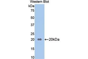 Detection of Recombinant APOB, Mouse using Polyclonal Antibody to Apolipoprotein B (APOB) (APOB Antikörper  (AA 3360-3526))