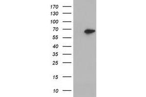 Western Blotting (WB) image for anti-Epoxide Hydrolase 2, Cytoplasmic (EPHX2) antibody (ABIN1500856) (EPHX2 Antikörper)