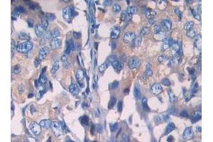 Used in DAB staining on fromalin fixed paraffin- embedded prostate gland tissue (SIGIRR Antikörper  (AA 1-118))