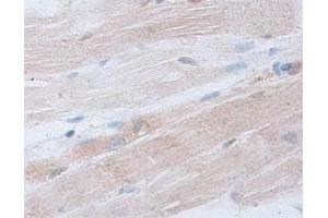Immunohistochemical staining of formalin-fixed paraffin-embedded human skeletal muscle tissue showing cytoplasmic staining with ACTRT2 polyclonal antibody  at 1 : 100 dilution. (ACTRT2 Antikörper  (C-Term))