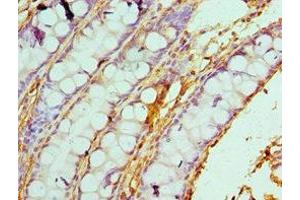 Immunohistochemistry of paraffin-embedded human colon tissue using ABIN7146462 at dilution of 1:100 (Caldesmon Antikörper  (AA 1-240))
