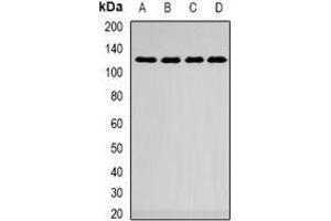 Western blot analysis of SMARCAD1 expression in A549 (A), HepG2 (B), mouse kidney (C), mouse lung (D) whole cell lysates.