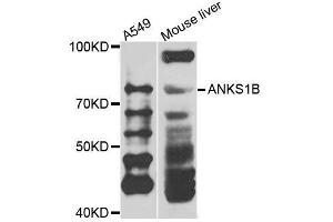 Western blot analysis of extracts of various cell lines, using ANKS1B antibody. (ANKS1B Antikörper  (AA 261-510))