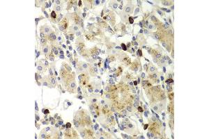 Immunohistochemistry (IHC) image for anti-Matrix Metallopeptidase 9 (Gelatinase B, 92kDa Gelatinase, 92kDa Type IV Collagenase) (MMP9) (AA 538-707) antibody (ABIN3022900)