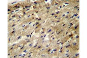 ABCD2 antibody immunohistochemistry analysis in formalin fixed and paraffin embedded human heart tissue. (CCL17 Antikörper  (AA 553-582))