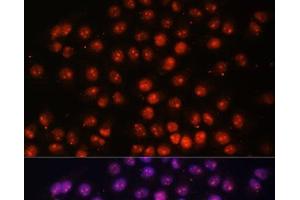 Immunofluorescence analysis of HeLa cells using TFEB Polyclonal Antibody at dilution of 1:100. (TFEB Antikörper)