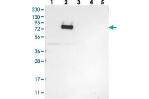 Western blot analysis of Lane 1: RT-4, Lane 2: U-251 MG, Lane 3: Human Plasma, Lane 4: Liver, Lane 5: Tonsil with GLT25D2 polyclonal antibody .