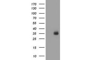 HEK293T cells were transfected with the pCMV6-ENTRY control (Left lane) or pCMV6-ENTRY VSIG2 (Right lane) cDNA for 48 hrs and lysed. (VSIG2 Antikörper)