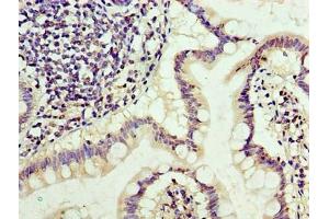 Immunohistochemistry of paraffin-embedded human small intestine tissue using ABIN7171285 at dilution of 1:100 (TRBC1 Antikörper  (AA 1-176))