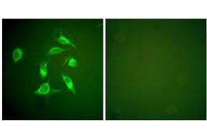 Immunofluorescence analysis of HeLa cells, using PDGFR alpha antibody.