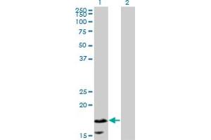 Western Blotting (WB) image for anti-Calmodulin-Like 5 (CALML5) (AA 1-147) antibody (ABIN599566) (CALML5 Antikörper  (AA 1-147))