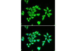 Immunofluorescence analysis of MCF-7 cell using PTRH2 antibody. (PTRH2 Antikörper)