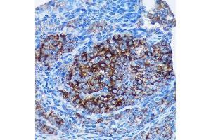 Immunohistochemistry of paraffin-embedded Rat ovary using MRPL30 Rabbit pAb (ABIN7268567) at dilution of 1:100 (40x lens). (MRPL30 Antikörper  (AA 1-161))