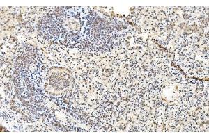 IHC analysis of LSM2 using anti-LSM2 antibody (ABIN7602832).