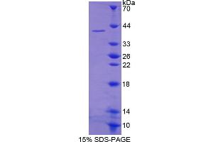 Image no. 1 for Poly A Specific Ribonuclease (PARN) (AA 178-245) protein (His tag,GST tag) (ABIN6236839) (PARN Protein (AA 178-245) (His tag,GST tag))