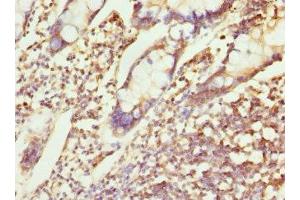 Immunohistochemistry of paraffin-embedded human small intestine tissue using ABIN7147524 at dilution of 1:100 (CHMP4B Antikörper  (AA 1-224))