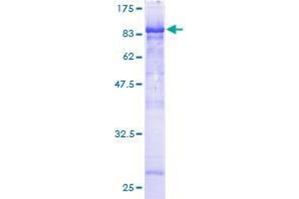 CDK5RAP3 Protein (AA 1-506) (GST tag)