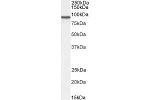Image no. 2 for anti-ArfGAP with Coiled-Coil, Ankyrin Repeat and PH Domains 2 (ACAP2) antibody (ABIN5893415) (Centaurin beta 2 Antikörper)