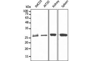 RAB11B Antikörper  (C-Term)