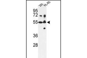 Western blot analysis of CYP21A2 Antibody (N-term) (ABIN392363 and ABIN2842000) in 293, HL-60 cell line lysates (35 μg/lane).