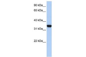 Western Blotting (WB) image for anti-Lactate Dehydrogenase A (LDHA) (Middle Region) antibody (ABIN2785876)