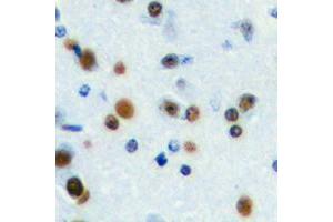 Immunohistochemical analysis of ANKRD30A staining in human brain formalin fixed paraffin embedded tissue section. (ANKRD30A Antikörper  (C-Term))