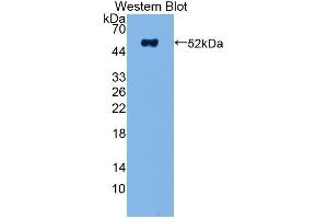 Detection of Recombinant NME5, Human using Polyclonal Antibody to Non Metastatic Cells 5, Protein NM23A Expressed In (NME5) (NME5 Antikörper  (AA 3-194))