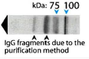 Western blot analysis on human brain lysate under reducing conditions using AP1B1 polyclonal antibody  at a dilution of 1 : 100. (AP1B1 Antikörper  (AA 11-29))