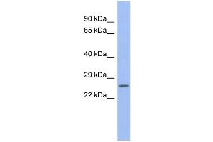 WB Suggested Anti-ZNRF1 Antibody Titration:  0. (ZNRF1 Antikörper  (N-Term))