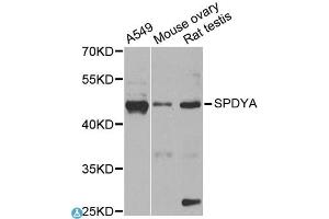 Western blot analysis of extracts of various cell lines, using SPDYA antibody (ABIN1874919) at 1:1000 dilution.