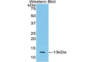 Western blot analysis of the recombinant protein. (AMH Antikörper)