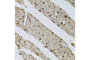 Immunohistochemistry of paraffin-embedded mouse heart using PHF1 antibody (ABIN5974685) at dilution of 1/100 (40x lens). (PHF1 Antikörper)