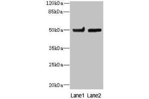 Western blot All lanes: TUBB6 antibody at 4 μg/mL Lane 1: Hela whole cell lysate Lane 2: MDA-MB-231 whole cell lysate Secondary Goat polyclonal to rabbit IgG at 1/10000 dilution Predicted band size: 50 kDa Observed band size: 50 kDa (TUBb6 Antikörper  (AA 1-446))