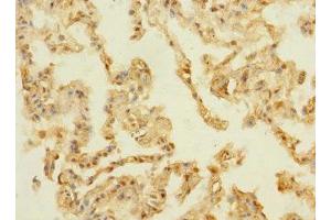Immunohistochemistry of paraffin-embedded human lung tissue using ABIN7159336 at dilution of 1:100 (PAQR5 Antikörper  (AA 1-51))