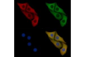anti-CD302 (CD302) (Internal Region) antibody