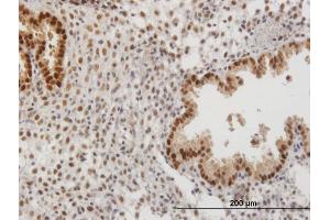 Immunoperoxidase of purified MaxPab antibody to PAPSS2 on formalin-fixed paraffin-embedded human endometrium.