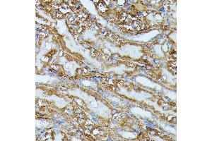 Immunohistochemistry of paraffin-embedded mouse kidney using IVD antibody (ABIN7268031) at dilution of 1:100 (40x lens). (IVD Antikörper  (AA 33-200))